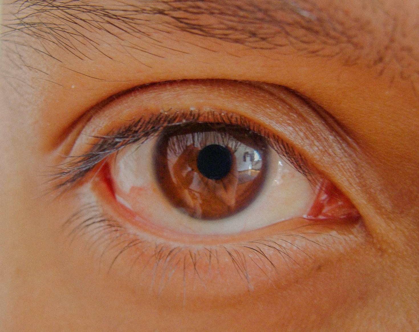 Simple Eye Exercises for Stress Relief